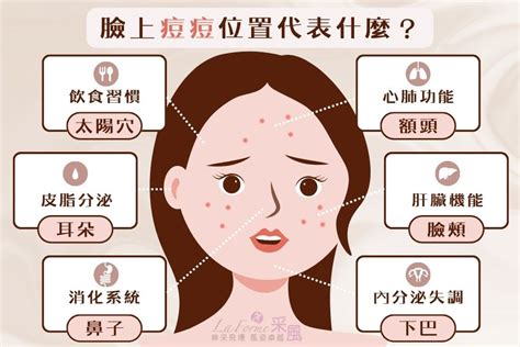 痘痘位置代表什么|痘痘一直好不了？痘痘位置代表什麼？醫師2招治療痘。